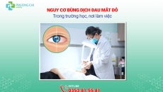 Nguy cơ bùng dịch đau mắt đỏ trong trường học, nơi làm việc