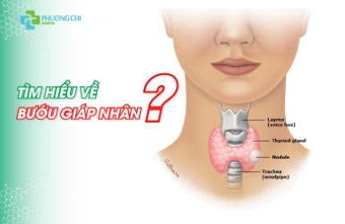 PCGH: Tìm hiểu về bướu giáp nhân