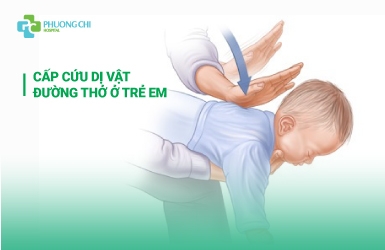 Cấp cứu dị vật đường thở ở trẻ em
