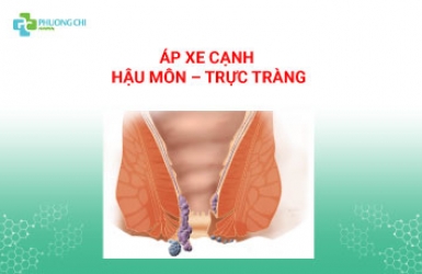 ÁP XE CẠNH HẬU MÔN – TRỰC TRÀNG