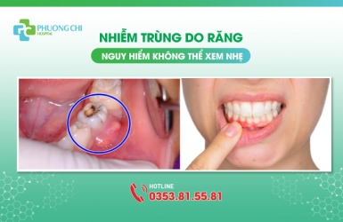Nhiễm trùng do răng: Nguy hiểm không thể xem nhẹ
